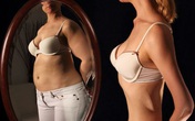5 hội chứng ám ảnh ngỡ là vô lý nhưng có thật mà không phải ai cũng biết mình mắc 5 hội chứng ám ảnh ngỡ là vô lý nhưng có thật mà không phải ai cũng biết mình mắc