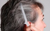 Xem vị trí tóc bạc đoán bệnh của gan, thận, dạ dày, lá lách Xem vị trí tóc bạc đoán bệnh của gan, thận, dạ dày, lá lách