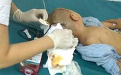 Thái Bình: Bé trai 3 tuổi đi học ở trường mầm non bị tụ máu 1/4 não phải mổ cấp cứu Thái Bình: Bé trai 3 tuổi đi học ở trường mầm non bị tụ máu 1/4 não phải mổ cấp cứu