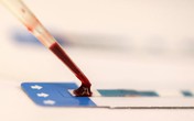 Bước tiến mới về vắc xin ngừa HIV Bước tiến mới về vắc xin ngừa HIV