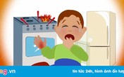 Trẻ bỏng nặng do sự vô ý của cha mẹ Trẻ bỏng nặng do sự vô ý của cha mẹ