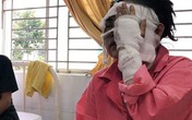Cô gái sắp cưới bị tạt axit hỏng 2 mắt ở Sài Gòn: 'Tôi đau đớn lắm, có thể đám cưới sẽ phải dời lại để lo chữa trị' Cô gái sắp cưới bị tạt axit hỏng 2 mắt ở Sài Gòn: 'Tôi đau đớn lắm, có thể đám cưới sẽ phải dời lại để lo chữa trị'