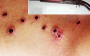 Dùng súng hoa cải thanh toán đối thủ trong đêm khuya Dùng súng hoa cải thanh toán đối thủ trong đêm khuya