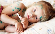 Cẩn trọng nhiễm trùng máu khi tùy tiện dùng Đông y trị thủy đậu Cẩn trọng nhiễm trùng máu khi tùy tiện dùng Đông y trị thủy đậu