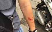Vụ 2 sinh viên bị quản lý trung tâm gia sư đánh chảy máu mũi: Không chấp nhận việc xin lỗi qua loa Vụ 2 sinh viên bị quản lý trung tâm gia sư đánh chảy máu mũi: Không chấp nhận việc xin lỗi qua loa