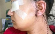 Phát hiện vết sưng nhỏ trên mặt trước khi sinh, người mẹ trẻ đâu ngờ sau 2 tuần lại trở thành khối u ác tính và cô mắc bệnh ung thư giai đoạn cuối Phát hiện vết sưng nhỏ trên mặt trước khi sinh, người mẹ trẻ đâu ngờ sau 2 tuần lại trở thành khối u ác tính và cô mắc bệnh ung thư giai đoạn cuối