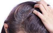 Đau đầu về tóc bạc sớm và đây là cách chuyên gia khuyên bạn Đau đầu về tóc bạc sớm và đây là cách chuyên gia khuyên bạn