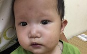 Bé gái 10 tháng tuổi mắc bệnh tim “khất lần” phẫu thuật vì... nghèo Bé gái 10 tháng tuổi mắc bệnh tim “khất lần” phẫu thuật vì... nghèo