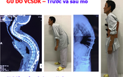 BV Bạch Mai ứng dụng thành công các hệ thống Robot hiện đại trong phẫu thuật, chi phí bằng 1/10 nước ngoài BV Bạch Mai ứng dụng thành công các hệ thống Robot hiện đại trong phẫu thuật, chi phí bằng 1/10 nước ngoài