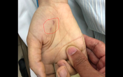 Hà Nội: Một nữ bác sĩ thú y trẻ tuổi tử vong vì chó ốm cắn vào tay Hà Nội: Một nữ bác sĩ thú y trẻ tuổi tử vong vì chó ốm cắn vào tay