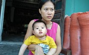 Xót xa cảnh mẹ mắc bệnh động kinh nuôi con bại não Xót xa cảnh mẹ mắc bệnh động kinh nuôi con bại não