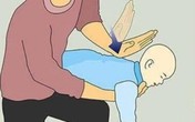 Liên tiếp các vụ tử vong vì hóc dị vật: Phòng ngừa và sơ cứu thế nào cho đúng? Liên tiếp các vụ tử vong vì hóc dị vật: Phòng ngừa và sơ cứu thế nào cho đúng?