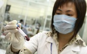 Từ vụ 42 người một xã ở Phú Thọ phát hiện nhiễm HIV: Làm gì nếu nghi ngờ phơi nhiễm HIV? Từ vụ 42 người một xã ở Phú Thọ phát hiện nhiễm HIV: Làm gì nếu nghi ngờ phơi nhiễm HIV?