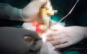 Nam thanh niên bị vòi hoa sen chui vào hậu môn vì thói quen dùng vòi xịt sau đại tiện Nam thanh niên bị vòi hoa sen chui vào hậu môn vì thói quen dùng vòi xịt sau đại tiện