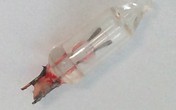 Bác sĩ phát hiện đèn trang trí trong phổi bé gái 14 tháng Bác sĩ phát hiện đèn trang trí trong phổi bé gái 14 tháng
