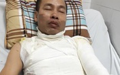 Hà Nội: Bố bị tạt a-xít, con 9 tuổi gào khóc trong xe Hà Nội: Bố bị tạt a-xít, con 9 tuổi gào khóc trong xe