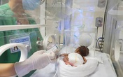 Chuyên gia chỉ rõ những sai lầm của mẹ khi chăm sóc con sinh non tháng Chuyên gia chỉ rõ những sai lầm của mẹ khi chăm sóc con sinh non tháng