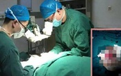 Người đàn ông bỗng nhiên tự tay cắt lìa... “của quý” Người đàn ông bỗng nhiên tự tay cắt lìa... “của quý”