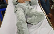Tài xế xe con bị chém vỡ đầu sau va chạm giao thông Tài xế xe con bị chém vỡ đầu sau va chạm giao thông