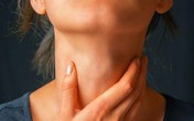 Căn bệnh ung thư liên quan đến hai 'món' cả triệu người Việt nghiện mê mẩn Căn bệnh ung thư liên quan đến hai 'món' cả triệu người Việt nghiện mê mẩn