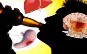 Quý ông Việt uống rượu, bia thuộc nhóm cao nhất thế giới Quý ông Việt uống rượu, bia thuộc nhóm cao nhất thế giới