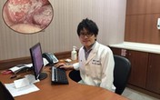 Bác sĩ hãi hùng khi thấy miệng bệnh nhân mốc trắng từng mảng, biết lý do còn choáng hơn Bác sĩ hãi hùng khi thấy miệng bệnh nhân mốc trắng từng mảng, biết lý do còn choáng hơn