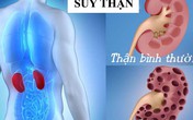 Những "sát thủ" tàn phá thận người Việt biết nhưng vẫn mắc phải Những "sát thủ" tàn phá thận người Việt biết nhưng vẫn mắc phải