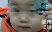 Bé trai 3 tuổi bị mù suốt 10 ngày chỉ vì bị cảm lạnh nhưng không điều trị dứt điểm Bé trai 3 tuổi bị mù suốt 10 ngày chỉ vì bị cảm lạnh nhưng không điều trị dứt điểm