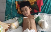 Mất đôi tay, cậu bé 12 tuổi bị điện giật chỉ mong giữ được đôi chân Mất đôi tay, cậu bé 12 tuổi bị điện giật chỉ mong giữ được đôi chân