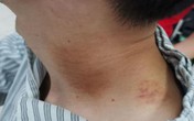 Bị đột quỵ cấp tính sau khi đi massage thư giãn, chuyên gia cảnh báo 6 dấu hiệu nguy hiểm Bị đột quỵ cấp tính sau khi đi massage thư giãn, chuyên gia cảnh báo 6 dấu hiệu nguy hiểm