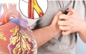 Chị em cần ghi nhớ dấu hiệu bệnh tim mạch nguy hiểm nhất nhiều người mắc Chị em cần ghi nhớ dấu hiệu bệnh tim mạch nguy hiểm nhất nhiều người mắc