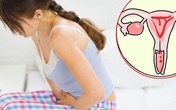 Vì không biết khi nào nên tầm soát ung thư, nhiều người mắc bệnh đã quá nặng Vì không biết khi nào nên tầm soát ung thư, nhiều người mắc bệnh đã quá nặng