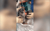 Kinh hãi lá phổi đen kịt của bệnh nhân sau 30 năm hút thuốc, nếu nhìn thấy bạn có còn dám hút thuốc? Kinh hãi lá phổi đen kịt của bệnh nhân sau 30 năm hút thuốc, nếu nhìn thấy bạn có còn dám hút thuốc?