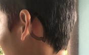 Thanh Hóa: Giấu dép của bạn, nam sinh lớp 8 bị nhóm phụ huynh hành hung tại trường học Thanh Hóa: Giấu dép của bạn, nam sinh lớp 8 bị nhóm phụ huynh hành hung tại trường học