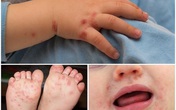 Hãy bảo vệ con bạn bằng việc rửa tay với xà phòng Hãy bảo vệ con bạn bằng việc rửa tay với xà phòng