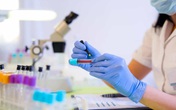Sau vụ 'cắt đôi que thử HIV' ở BV Xanh Pôn, Bộ Y tế yêu cầu 'siết' quản lý xét nghiệm, quản lý nội bộ Sau vụ 'cắt đôi que thử HIV' ở BV Xanh Pôn, Bộ Y tế yêu cầu 'siết' quản lý xét nghiệm, quản lý nội bộ