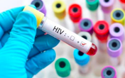 3 em bé phơi nhiễm HIV do bị người nghi ngáo đá tấn công, xử lý vết thương ra sao? 3 em bé phơi nhiễm HIV do bị người nghi ngáo đá tấn công, xử lý vết thương ra sao?
