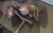 Hoàn cảnh đáng thương của chàng trai liệt tứ chi, mồ côi mẹ, bố bỏ đi Hoàn cảnh đáng thương của chàng trai liệt tứ chi, mồ côi mẹ, bố bỏ đi