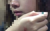 Hà Nội: Xin số điện thoại không được, nữ sinh bị kẻ lạ mặt sàm sỡ ngay trong thang máy chung cư Hà Nội: Xin số điện thoại không được, nữ sinh bị kẻ lạ mặt sàm sỡ ngay trong thang máy chung cư