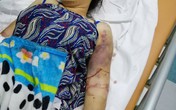 Vụ thai phụ bị tra tấn như thời trung cổ đến sảy thai: Mức án nào cho các đối tượng Vụ thai phụ bị tra tấn như thời trung cổ đến sảy thai: Mức án nào cho các đối tượng
