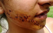 Đắk Lắk: Rạch mặt người tình vì nhớ lại chuyện bị "cắm sừng" Đắk Lắk: Rạch mặt người tình vì nhớ lại chuyện bị "cắm sừng"