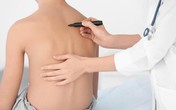 Cơ hội tốt cho trẻ cong vẹo cột sống được khám và tư vấn phẫu thuật với các chuyên gia hàng đầu Hoa Kỳ Cơ hội tốt cho trẻ cong vẹo cột sống được khám và tư vấn phẫu thuật với các chuyên gia hàng đầu Hoa Kỳ