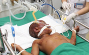 Ngã khi ngủ quên trên lưng trâu, bé gái bị kéo lê về tận nhà Ngã khi ngủ quên trên lưng trâu, bé gái bị kéo lê về tận nhà