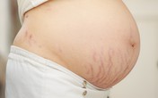 Mẹ bầu trong giỏ nhất định phải có thứ này Mẹ bầu trong giỏ nhất định phải có thứ này