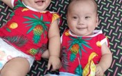 Rớt nước mắt hoàn cảnh bé sinh đôi mắc bệnh tim phức tạp cần phẫu thuật gấp Rớt nước mắt hoàn cảnh bé sinh đôi mắc bệnh tim phức tạp cần phẫu thuật gấp
