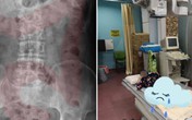 Bé gái 11 tuổi nhập viện cấp cứu vì đau dạ dày, bác sĩ chỉ đích danh thủ phạm là 1 sở thích tai hại của rất nhiều bé Bé gái 11 tuổi nhập viện cấp cứu vì đau dạ dày, bác sĩ chỉ đích danh thủ phạm là 1 sở thích tai hại của rất nhiều bé