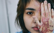 Người bán axit cho cựu thiếu úy công an: 'Tôi rất sốc' Người bán axit cho cựu thiếu úy công an: 'Tôi rất sốc'