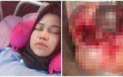 Cô gái có 2 khối u quái ở buồng trứng vì thích ăn loại thực phẩm nhiều người cũng mê Cô gái có 2 khối u quái ở buồng trứng vì thích ăn loại thực phẩm nhiều người cũng mê