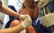 3 trẻ mầm non bỏng nặng vì cô giáo đốt cồn dạy kỹ năng... phòng cháy 3 trẻ mầm non bỏng nặng vì cô giáo đốt cồn dạy kỹ năng... phòng cháy