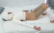 Tiếng khóc xé lòng của bé gái xinh xắn bỏng nặng toàn thân vì cồn đổ vào người Tiếng khóc xé lòng của bé gái xinh xắn bỏng nặng toàn thân vì cồn đổ vào người